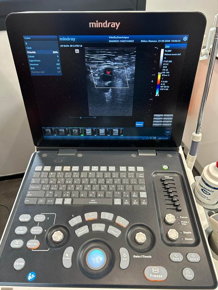 Mindray Z60